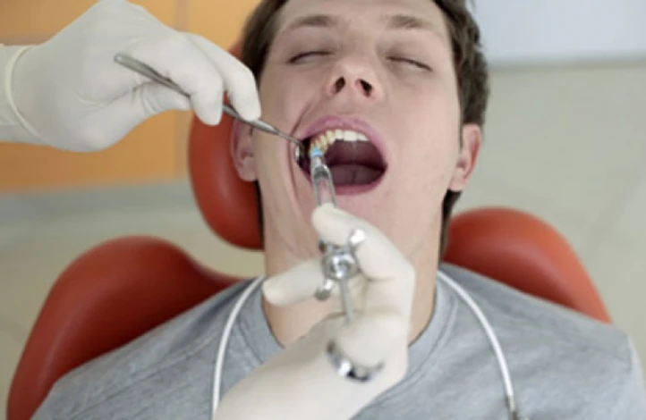 نکاتی که باید قبل از کشیدن دندان عقل بدانید